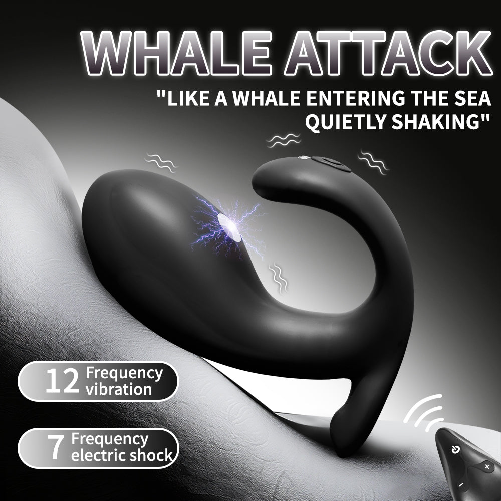 Electro-Shock Anal Plug – Microcurrent G-Spot Stimulator & SM Training Accessory for Men & Women